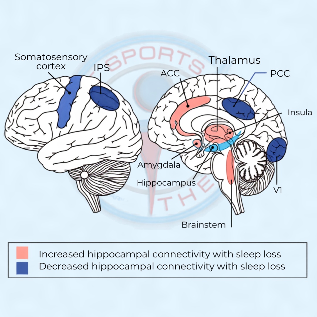 How sleep affects pain sensitivity in the brain